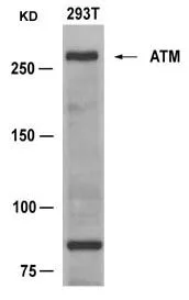 WB analysis of extracts from 293T cells using GTX50488 ATM antibody with or without blocking peptide.