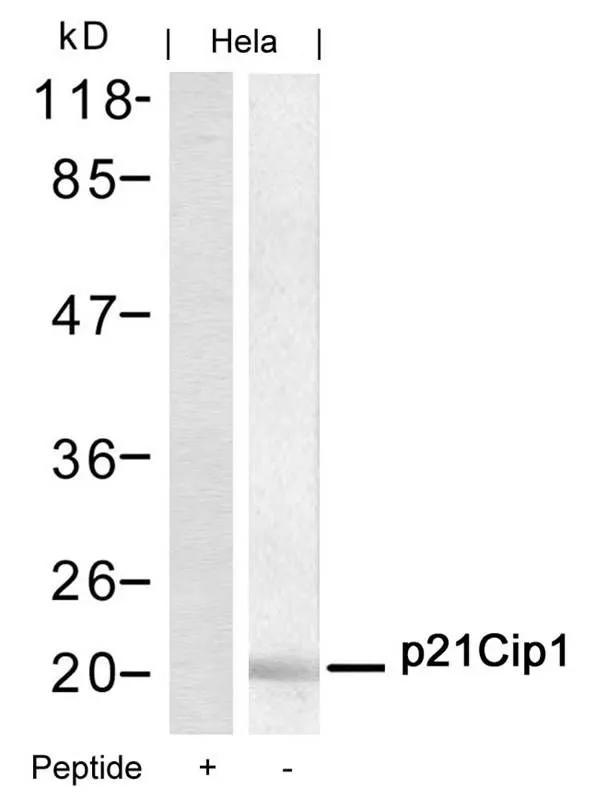 WB analysis of extracts from HeLa cells using GTX50490 p21 Cip1 antibody with or without blocking peptide. WB analysis of extracts from HeLa cells using GTX50490 p21 Cip1 antibody with or without blocking peptide.