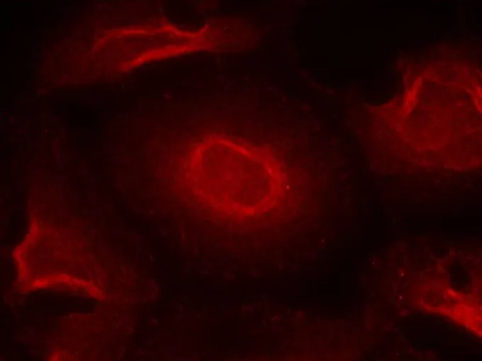 ICC/IF analysis of methanol-fixed HeLa cells using GTX50496 NMDAR2B antibody. ICC/IF analysis of methanol-fixed HeLa cells using GTX50496 NMDAR2B antibody.