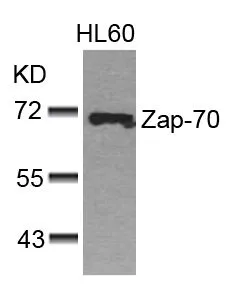 WB analysis of extracts from HL-60 cells using GTX50508 ZAP70 antibody.