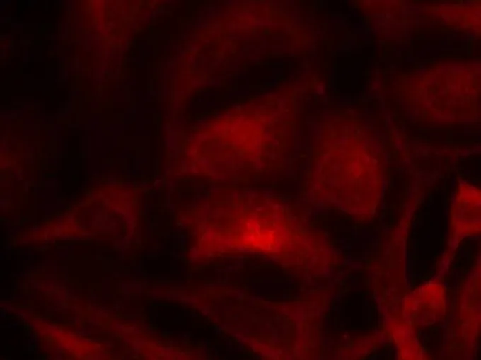 ICC/IF analysis of methanol-fixed HeLa cells using GTX50530 Rac1 antibody. ICC/IF analysis of methanol-fixed HeLa cells using GTX50530 Rac1 antibody.