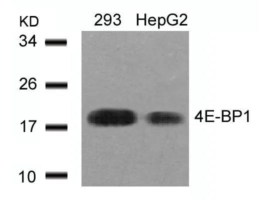 WB analysis of extracts from 293 and HepG2 cells using GTX50543 4E-BP1 antibody.