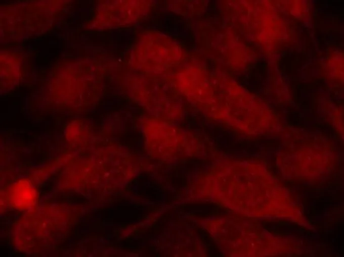 ICC/IF analysis of methanol-fixed HeLa cells using GTX50545 Stathmin 1 antibody. ICC/IF analysis of methanol-fixed HeLa cells using GTX50545 Stathmin 1 antibody.