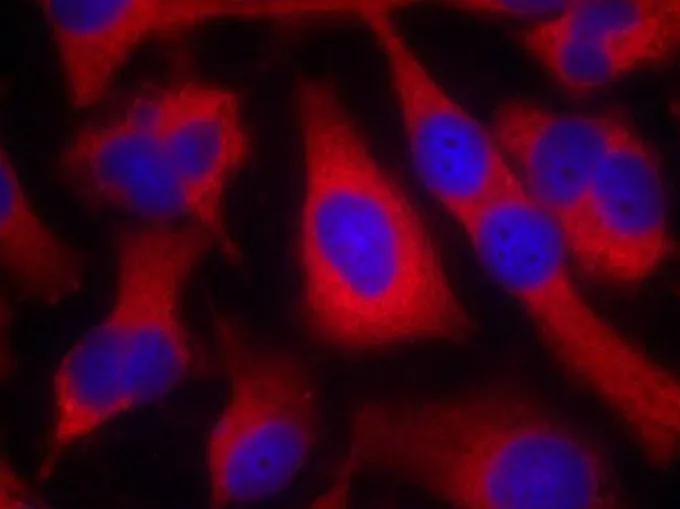 ICC/IF analysis of methanol-fixed HeLa cells using GTX50550 IRS1 antibody. ICC/IF analysis of methanol-fixed HeLa cells using GTX50550 IRS1 antibody.