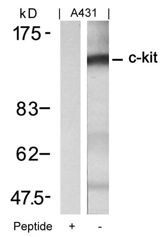 WB analysis of extracts from A431 cells using GTX50556 c-Kit antibody with or without blocking peptide. WB analysis of extracts from A431 cells using GTX50556 c-Kit antibody with or without blocking peptide.