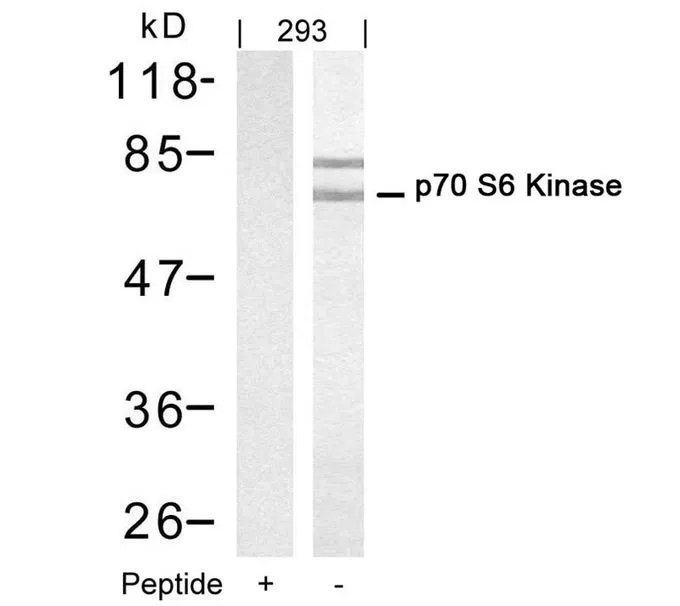 WB analysis of extracts from 293 cells using GTX50567 p70 S6K antibody. Lane 1 : Primary antibody pre-incubated with the antigen specific peptide