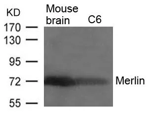 WB analysis of extracts from mouse brain tissue and C6 cells using GTX50579 Merlin antibody.