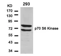 WB analysis of extracts from 293 cells using GTX50582 p70 S6K antibody.