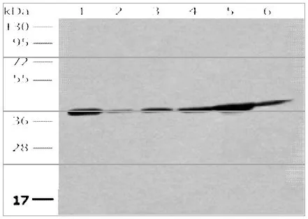 WB analysis of extracts from A549 cell, human placenta tissue, A172 cell, NIH/3T3 cell, Jurkat cell, HeLa cell using GTX50590 eIF2 alpha antibody. Dilution : 1:250