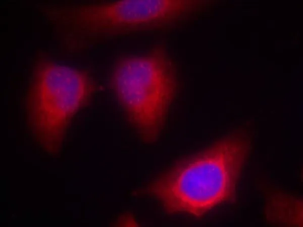 ICC/IF analysis of methanol-fixed HeLa cells using GTX50606 PKC theta antibody. ICC/IF analysis of methanol-fixed HeLa cells using GTX50606 PKC theta antibody.