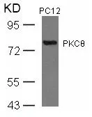 WB analysis of extracts from PC12 cells using GTX50606 PKC theta antibody.