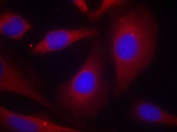 ICC/IF analysis of methanol-fixed HeLa cells using GTX50618 NFkB p105 antibody. ICC/IF analysis of methanol-fixed HeLa cells using GTX50618 NFkB p105 antibody.