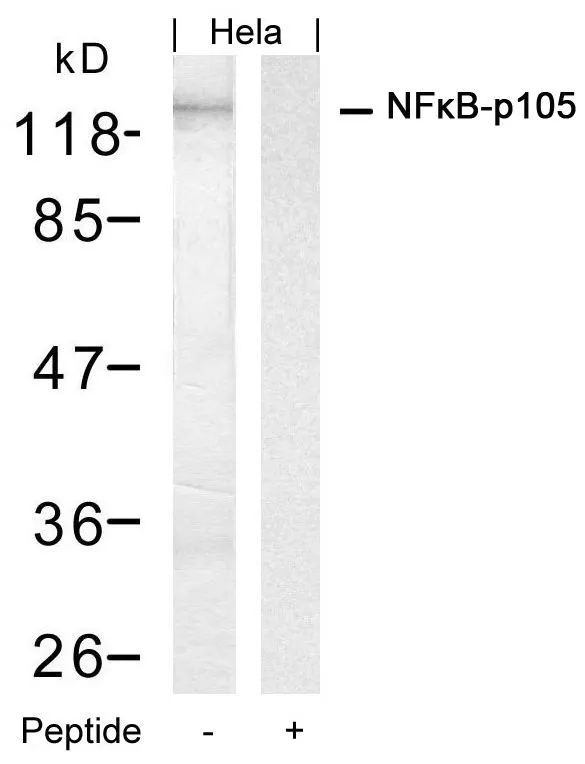 WB analysis of extracts from HeLa cells using GTX50618 NFkB p105 antibody with or without blocking peptide.