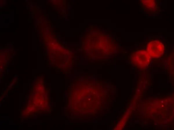 ICC/IF analysis of methanol-fixed HeLa cells using GTX50620 SHC1 antibody. ICC/IF analysis of methanol-fixed HeLa cells using GTX50620 SHC1 antibody.