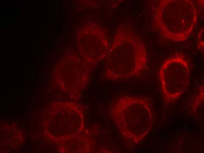 ICC/IF analysis of methanol-fixed HeLa cells using GTX50625 Smad1 antibody. ICC/IF analysis of methanol-fixed HeLa cells using GTX50625 Smad1 antibody.