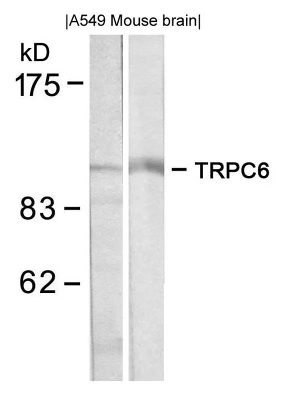 WB analysis of extracts from A549 and mouse brain tissue using GTX50636 TRPC6 antibody. WB analysis of extracts from A549 and mouse brain tissue using GTX50636 TRPC6 antibody.
