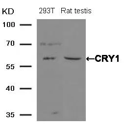 WB analysis of extracts from mouse brain tissue using GTX50642 CRY1 antibody.