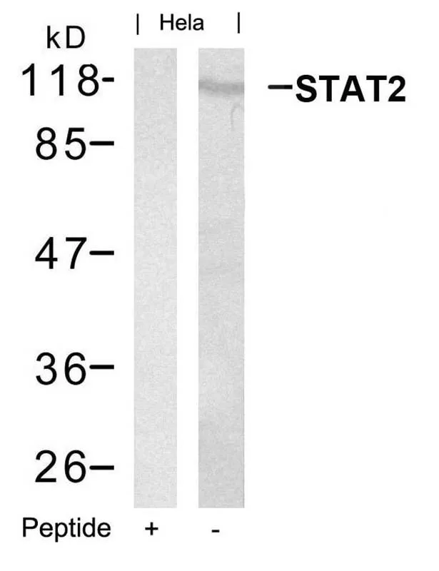 WB analysis of extracts from HeLa cells using GTX50661 STAT2 antibody with or without blocking peptide.