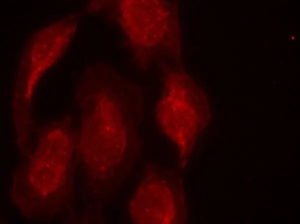 ICC/IF analysis of methanol-fixed HeLa cells using GTX50664 CDK6 antibody. ICC/IF analysis of methanol-fixed HeLa cells using GTX50664 CDK6 antibody.