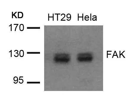 WB analysis of extracts from HT-29 and HeLa cells using GTX50666 FAK antibody.