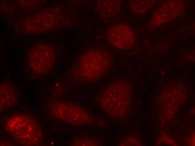 ICC/IF analysis of methanol-fixed MCF-7 cells using GTX50682 PKC beta 2 (phospho Thr641) antibody. ICC/IF analysis of methanol-fixed MCF-7 cells using GTX50682 PKC beta 2 (phospho Thr641) antibody.