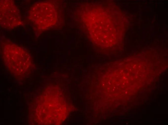 ICC/IF analysis of methanol-fixed HeLa cells using GTX50685 CARM1 antibody. ICC/IF analysis of methanol-fixed HeLa cells using GTX50685 CARM1 antibody.