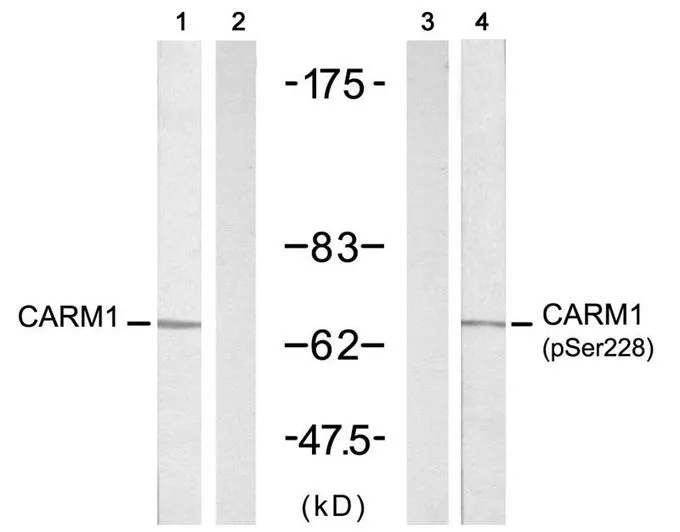 WB analysis of extracts from A431 cells untreated or treated with EGF (200ng/ml 5min) using GTX50685 CARM1 antibody.