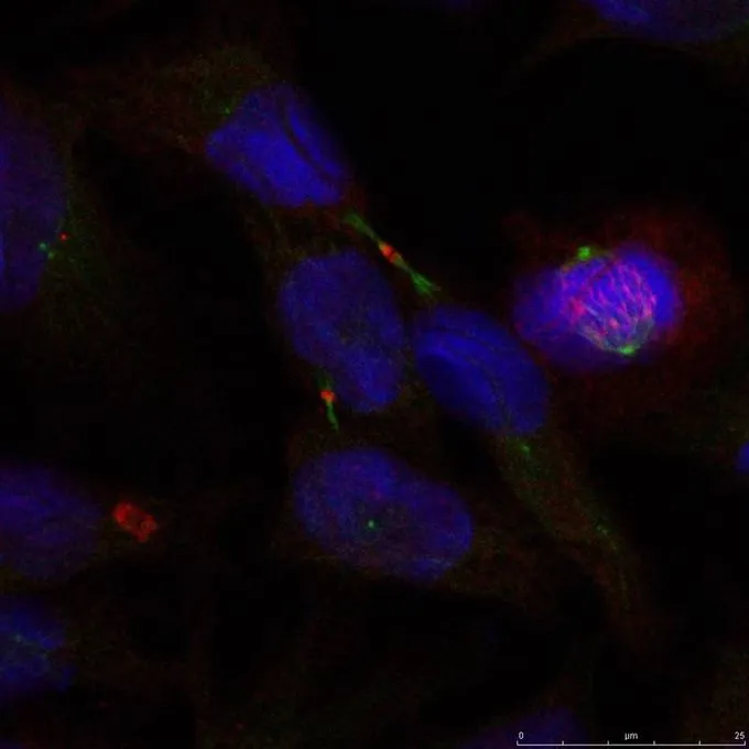 ICC/IF analysis of methanol-fixed HeLa cells using GTX50691 ELK1 antibody. ICC/IF analysis of methanol-fixed HeLa cells using GTX50691 ELK1 antibody.