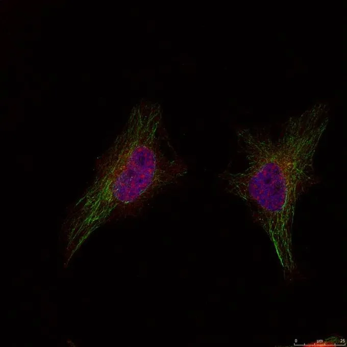 ICC/IF analysis of methanol-fixed HeLa cells using GTX50692 BRCA1 antibody. ICC/IF analysis of methanol-fixed HeLa cells using GTX50692 BRCA1 antibody.