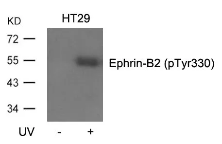 WB analysis of extracts from HT-29 cells untreated or treated with UV using GTX50700 Ephrin B2 (phospho Tyr330) antibody. WB analysis of extracts from HT-29 cells untreated or treated with UV using GTX50700 Ephrin B2 (phospho Tyr330) antibody.
