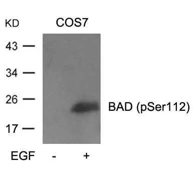 WB analysis of extracts from COS-7 cells untreated or treated with EGF using GTX50702 Bad (phospho Ser112) antibody.