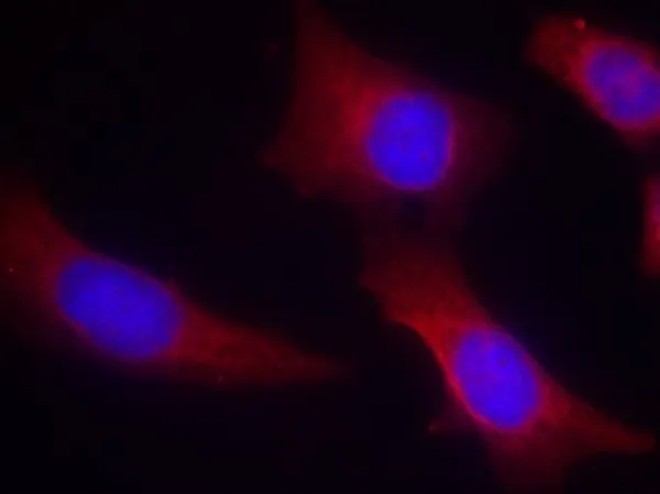 IHC-P analysis of human hippocampal region tissue from the falling sickness disease using GTX50706 CaMKII alpha antibody. IHC-P analysis of human hippocampal region tissue from the falling sickness disease using GTX50706 CaMKII alpha antibody.