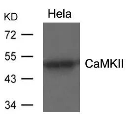 WB analysis of extracts from HeLa cells using GTX50706 CaMKII alpha antibody.