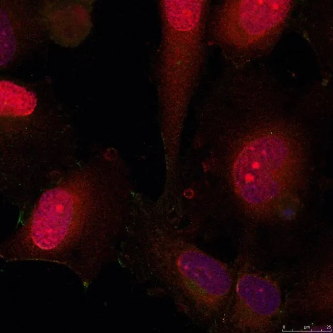 ICC/IF analysis of methanol-fixed HeLa cells using GTX50709 STAT3 antibody. ICC/IF analysis of methanol-fixed HeLa cells using GTX50709 STAT3 antibody.