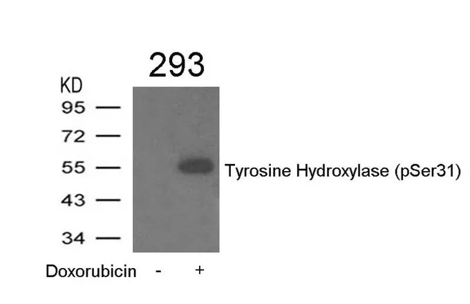 WB analysis of extracts from 293 cells treated with Doxorubicin using GTX50711 Tyrosine Hydroxylase (phospho Ser31) antibody. WB analysis of extracts from 293 cells treated with Doxorubicin using GTX50711 Tyrosine Hydroxylase (phospho Ser31) antibody.