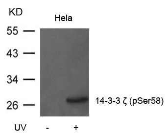 WB analysis of extracts from HeLa cells untreated or treated with UV using GTX50712 14-3-3 zeta (phospho Ser58) antibody.
