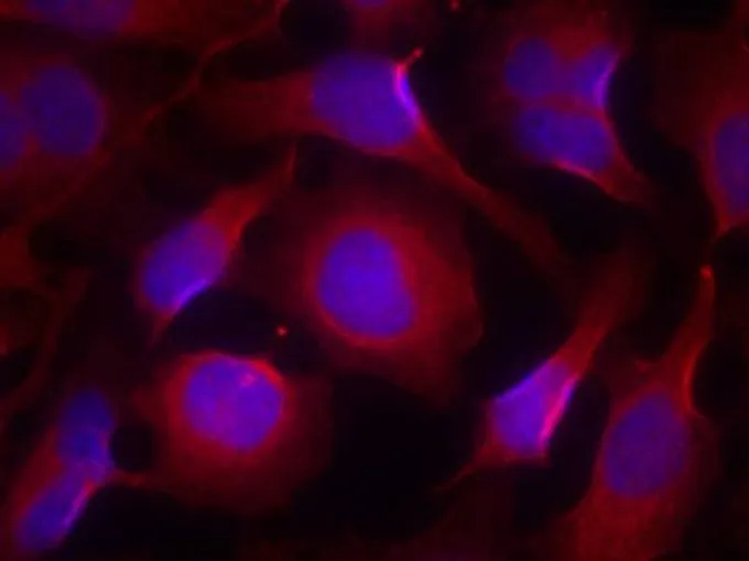 ICC/IF analysis of methanol-fixed HeLa cells using GTX50715 PYK2 antibody. ICC/IF analysis of methanol-fixed HeLa cells using GTX50715 PYK2 antibody.