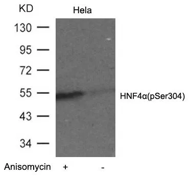 WB analysis of extracts from HeLa cells untreated or treated with Anisomyclin using GTX50719 HNF4 alpha (phospho Ser304) antibody. WB analysis of extracts from HeLa cells untreated or treated with Anisomyclin using GTX50719 HNF4 alpha (phospho Ser304) antibody.