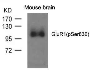 WB analysis of extracts from mouse brain tissue using GTX50729 GluR1 (phospho Ser818) antibody. WB analysis of extracts from mouse brain tissue using GTX50729 GluR1 (phospho Ser818) antibody.