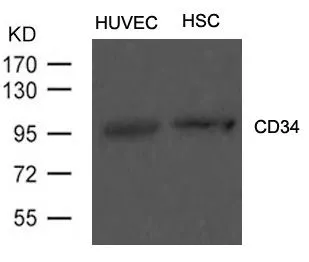 WB analysis of extracts from HUVEC cells and hematopoietic stem cells from umbilical cord blood using GTX50754 CD34 antibody. WB analysis of extracts from HUVEC cells and hematopoietic stem cells from umbilical cord blood using GTX50754 CD34 antibody.