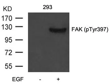 WB analysis of extracts from 293 cells untreated or treated with EGF using GTX50760 FAK (phospho Tyr397) antibody. WB analysis of extracts from 293 cells untreated or treated with EGF using GTX50760 FAK (phospho Tyr397) antibody.