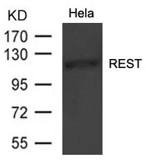 WB analysis of extracts from HeLa cells using GTX50761 REST antibody.