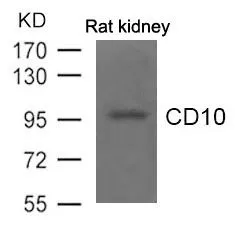 WB analysis of extracts from rat kidney tissue using GTX50766 CD10 antibody. WB analysis of extracts from rat kidney tissue using GTX50766 CD10 antibody.
