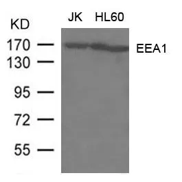 WB analysis of extracts from JK and HL-60 cells using GTX50769 EEA1 antibody. WB analysis of extracts from JK and HL-60 cells using GTX50769 EEA1 antibody.