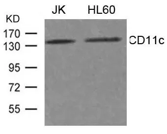 WB analysis of extracts from JK and HL-60 cells using GTX50770 CD11c antibody. WB analysis of extracts from JK and HL-60 cells using GTX50770 CD11c antibody.