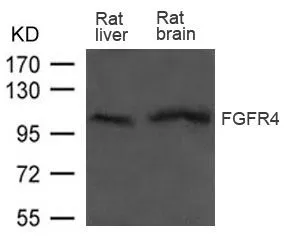 WB analysis of extracts from rat liver and brain tissue using GTX50782 FGFR4 antibody. WB analysis of extracts from rat liver and brain tissue using GTX50782 FGFR4 antibody.