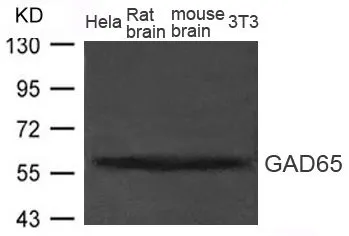 WB analysis of extracts from rat brain, mouse brain tissue, HeLa, and 3T3 cells using GTX50783 GAD65 antibody. WB analysis of extracts from rat brain, mouse brain tissue, HeLa, and 3T3 cells using GTX50783 GAD65 antibody.