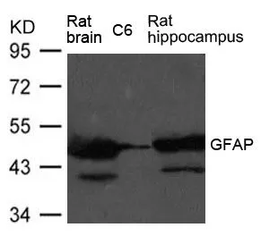 WB analysis of extracts from rat brain, rat hippocampus tissue, and C6 cells using GTX50797 GFAP antibody.