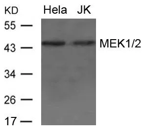WB analysis of extracts from HeLa and JK cells using GTX50813 MEK1 + MEK2 antibody. WB analysis of extracts from HeLa and JK cells using GTX50813 MEK1 + MEK2 antibody.