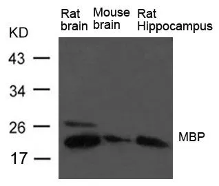 WB analysis of extracts from rat brain, mouse brain, and rat hippocampus tissue using GTX50815 Myelin basic protein antibody. WB analysis of extracts from rat brain, mouse brain, and rat hippocampus tissue using GTX50815 Myelin basic protein antibody.